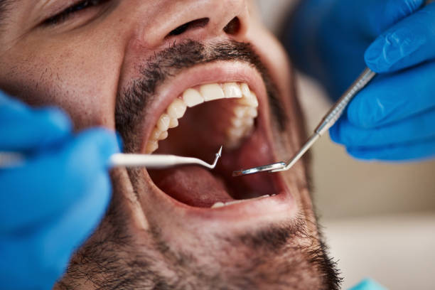Best Cosmetic Dentistry  in Yates Center, KS